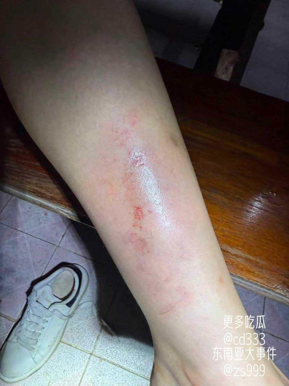 中国女子曼谷误乘导游车遭四名泰国男子劫持并捆绑后跳车逃生