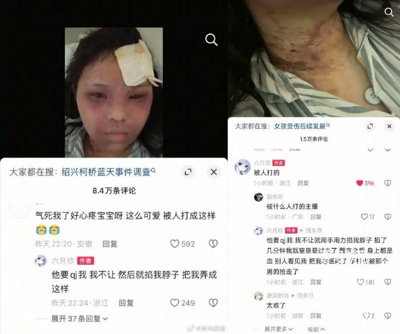 18岁博主绍兴公厕遭陌生男子尾随强暴并抢劫致窒息昏迷