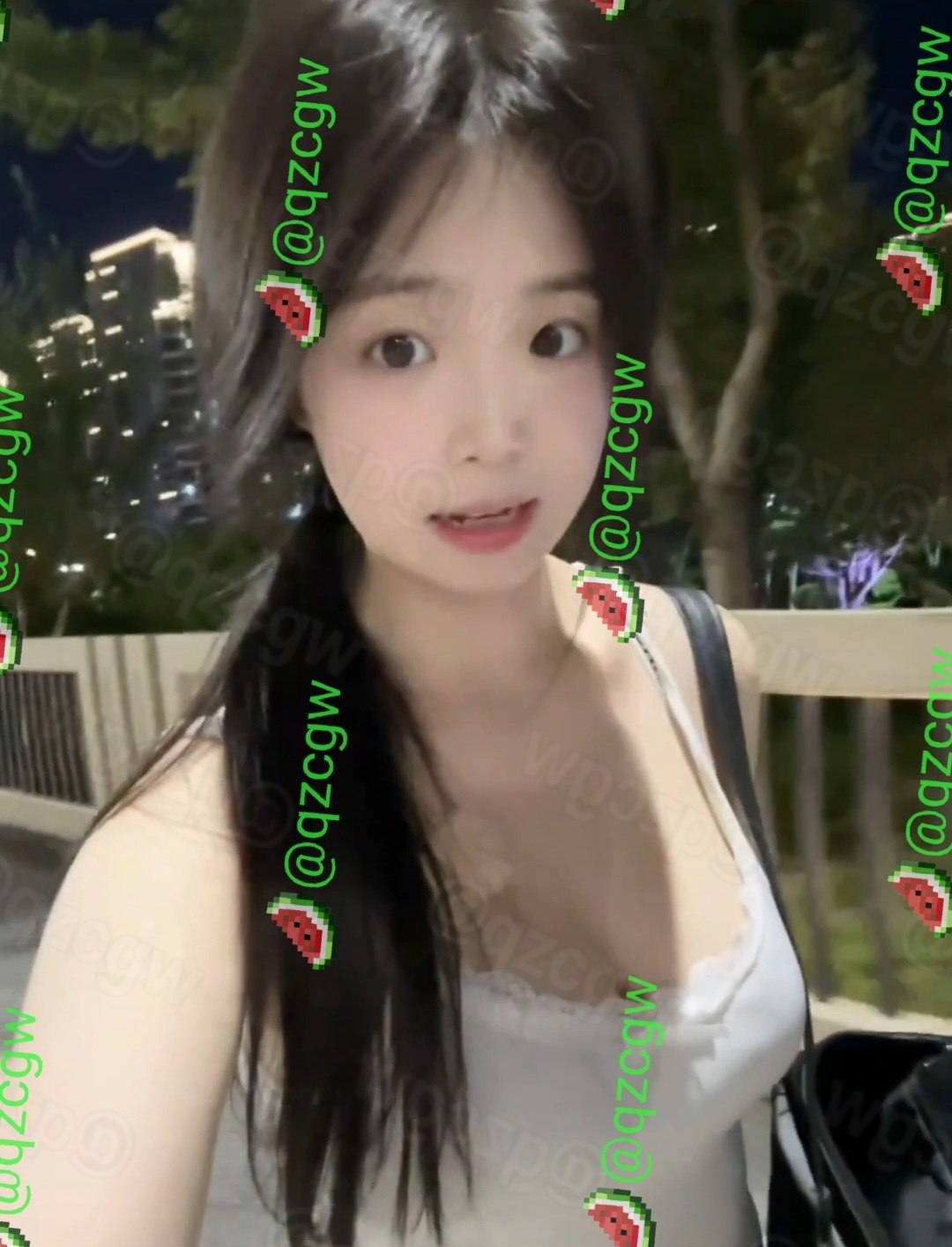 甜美微胖女生夜间骑行不慎撞上路边石墩导致脚部严重肿胀受伤